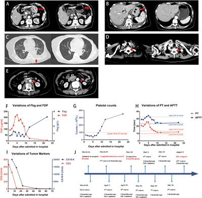 Case report: PD-1 inhibitor-based treatment strategies in gastric cancer complicated by bone marrow metastasis and disseminated intravascular coagulation: A report of two cases